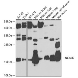 NCALD Rabbit pAb