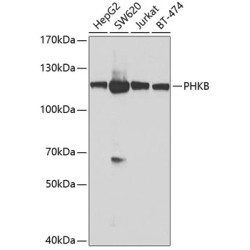 PHKB Rabbit pAb