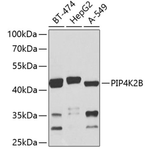 PIP4K2B Rabbit pAb