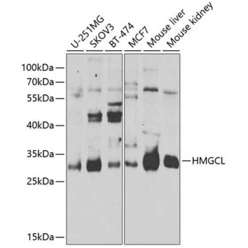 HMGCL Rabbit pAb