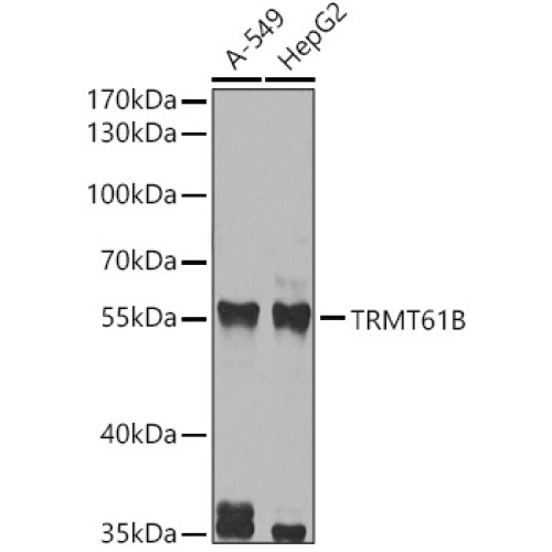 TRMT61B Rabbit pAb