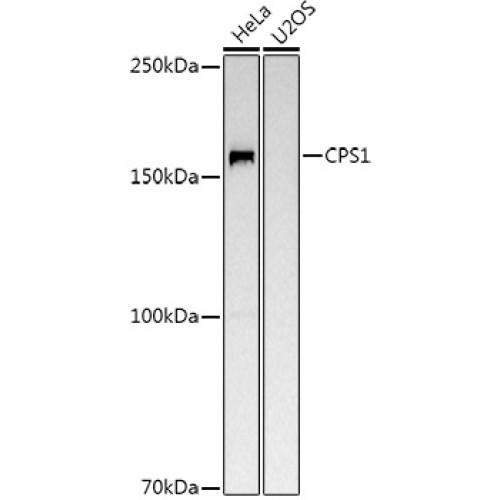 CPS1 Rabbit pAb