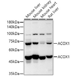 ACOX1 Rabbit pAb