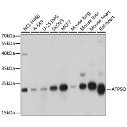 ATP5O Rabbit pAb