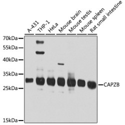 CAPZB Rabbit pAb