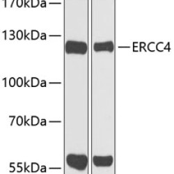 ERCC4 Rabbit pAb