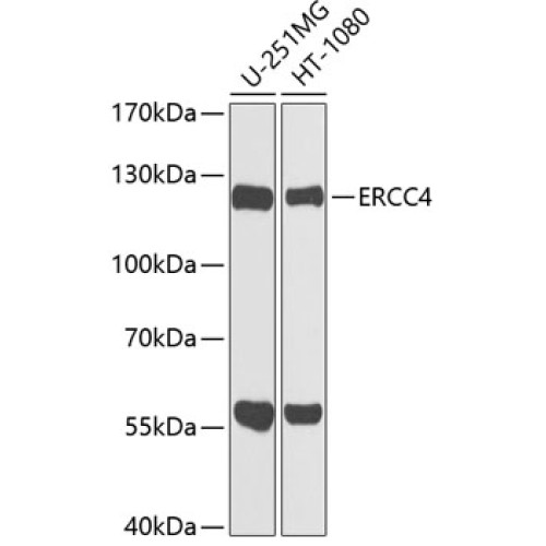ERCC4 Rabbit pAb