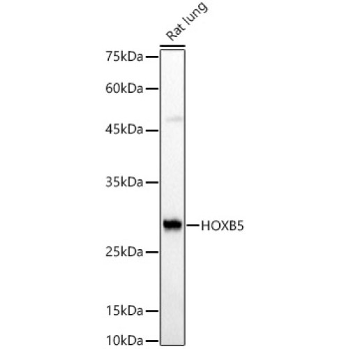 HOXB5 Rabbit pAb
