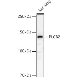 PLCB2 Rabbit pAb