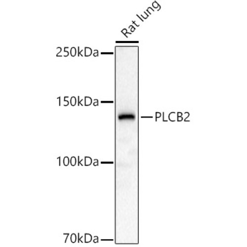 PLCB2 Rabbit pAb