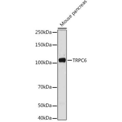 TRPC6 Rabbit pAb