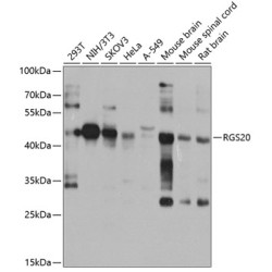 RGS20 Rabbit pAb