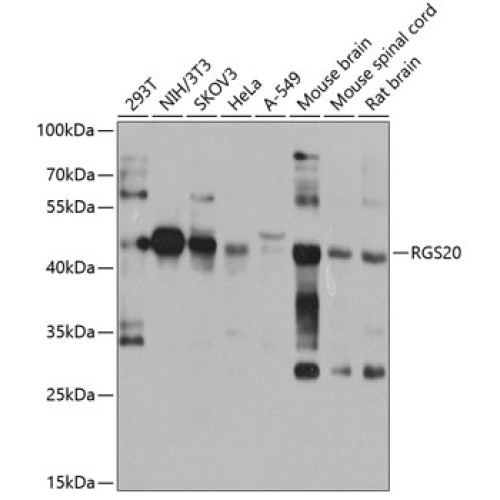 RGS20 Rabbit pAb