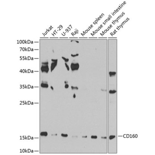 CD160 Rabbit pAb