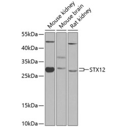 STX12 Rabbit pAb