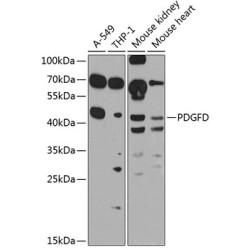 PDGFD Rabbit pAb