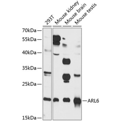 ARL6 Rabbit pAb