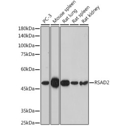 RSAD2 Rabbit pAb