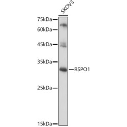 RSPO1 Rabbit pAb