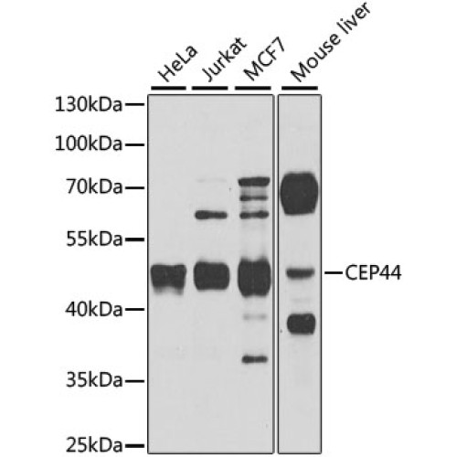 CEP44 Rabbit pAb