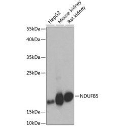 NDUFB5 Rabbit pAb