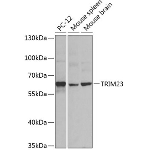 TRIM23 Rabbit pAb
