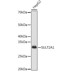 SULT2A1 Rabbit mAb