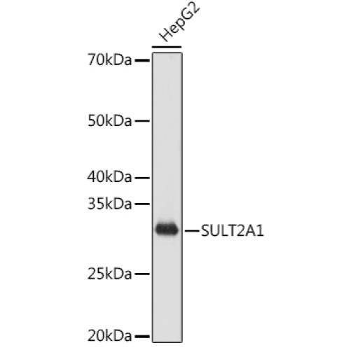 SULT2A1 Rabbit mAb