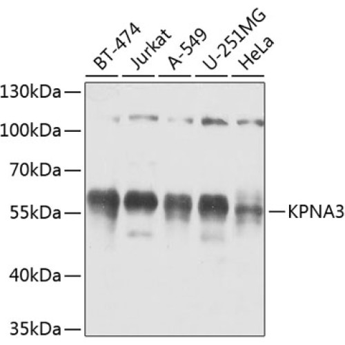 KPNA3 Rabbit pAb