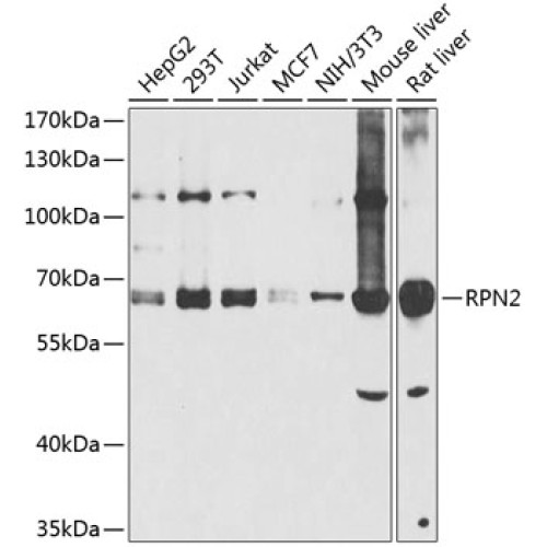 RPN2 Rabbit pAb