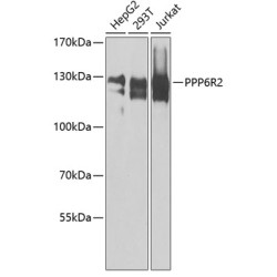 PPP6R2 Rabbit pAb