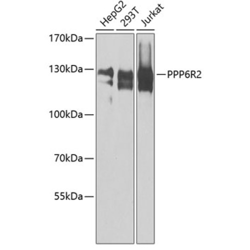 PPP6R2 Rabbit pAb