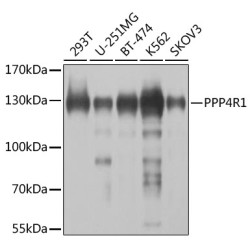 PPP4R1 Rabbit pAb