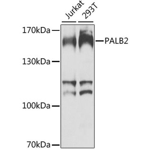 PALB2 Rabbit pAb