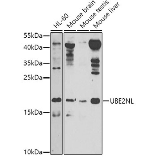 UBE2NL Rabbit pAb