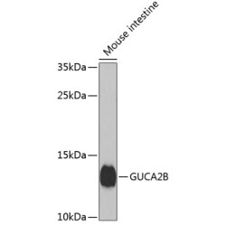 GUCA2B Rabbit pAb