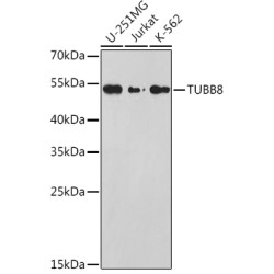 TUBB8 Rabbit pAb