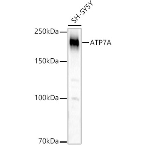 ATP7A Rabbit pAb