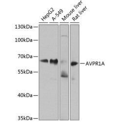 AVPR1A Rabbit pAb