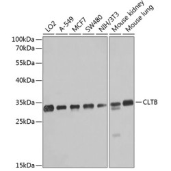 CLTB Rabbit pAb