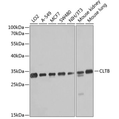 CLTB Rabbit pAb