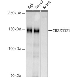 CR2/CD21 Rabbit pAb