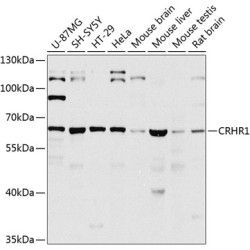 CRHR1 Rabbit pAb
