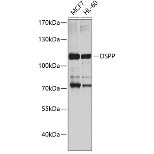 DSPP Rabbit pAb