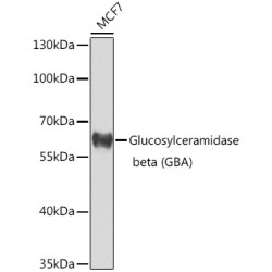 Glucosylceramidase beta (GBA) Rabbit pAb