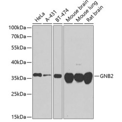 GNB2 Rabbit pAb