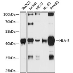 HLA-E Rabbit pAb