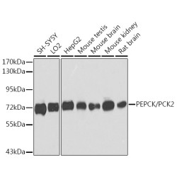 PEPCK/PCK2 Rabbit pAb