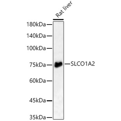 SLCO1A2 Rabbit pAb