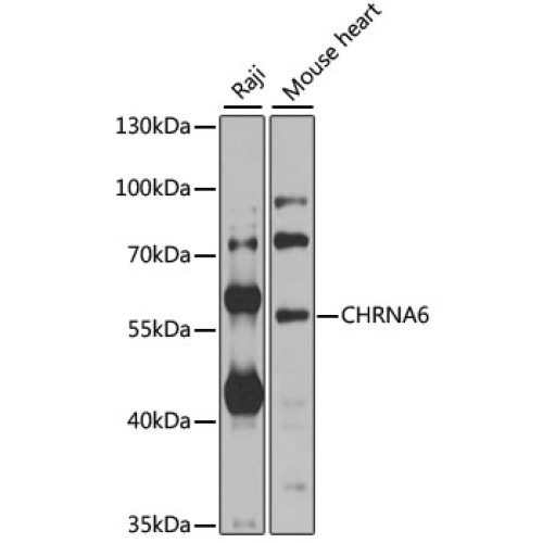 CHRNA6 Rabbit pAb